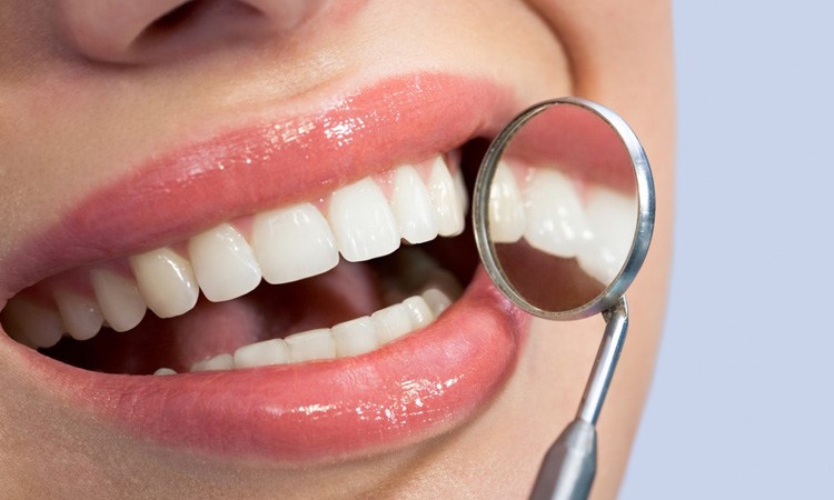 4 Reasons people plan a cosmetic dentistry Mexico trip